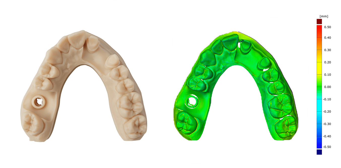 Restorative model on the left and a colored model at the right showing accuracy