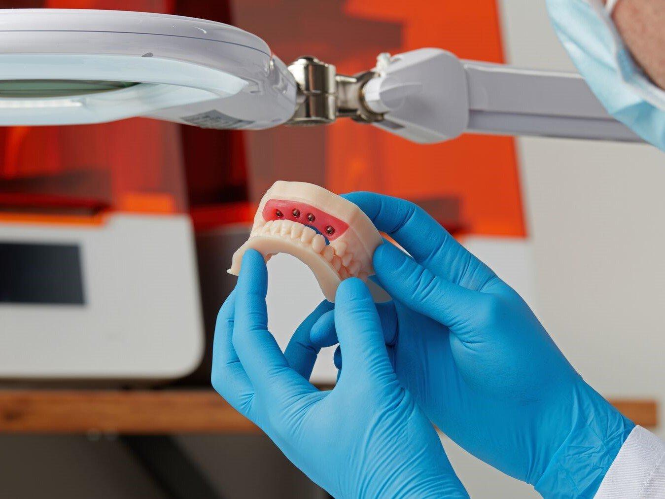 Zahnarzt bei der Arbeit mit einem 3D-gedruckten Modell aus Model Resin V3
