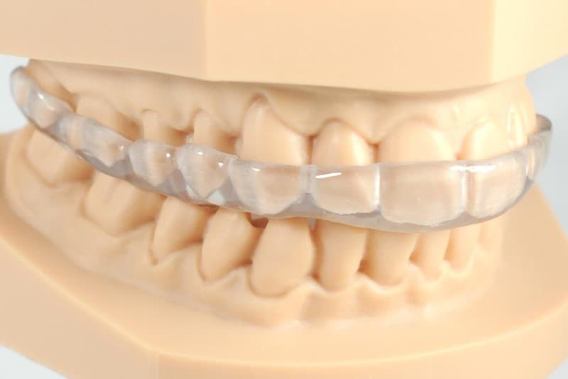 3D Printing Occlusal Splints with Formlabs SLA 3D Printers
