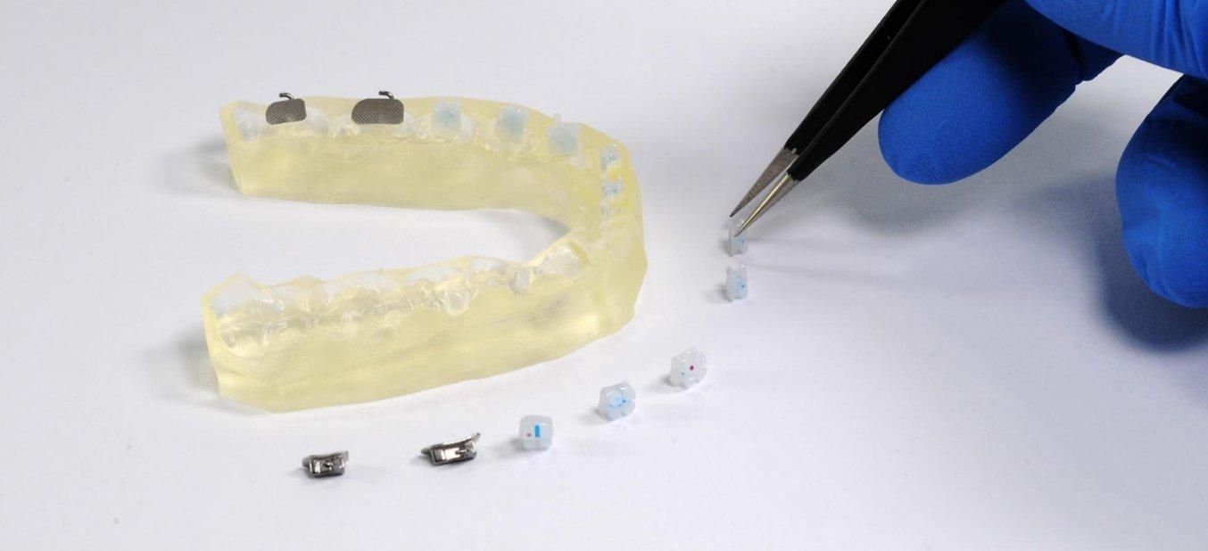 Pinces pour Orthodontie: Guide sur les différents types et leurs