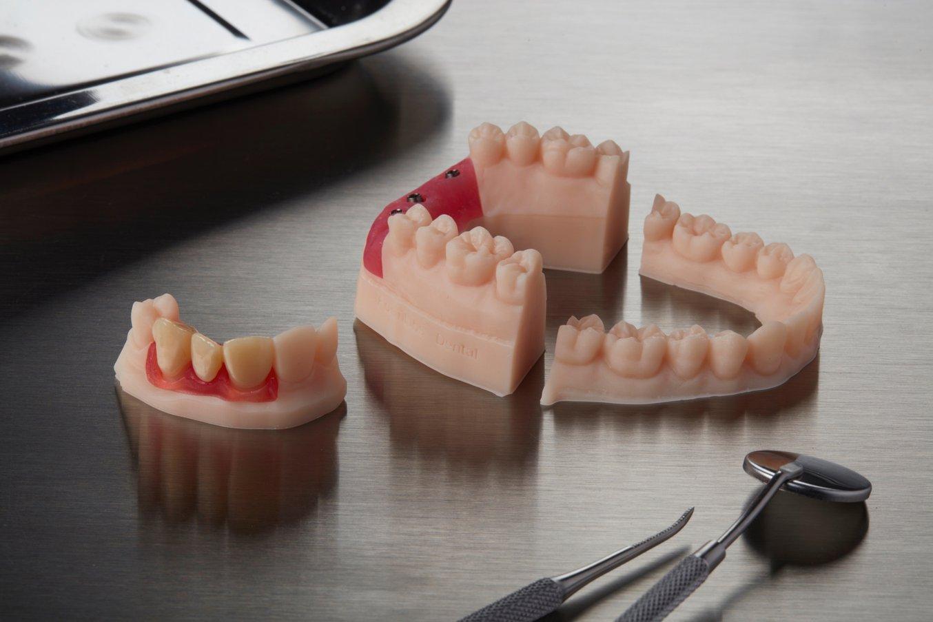 Uso delle resine per protesi dentali digitali