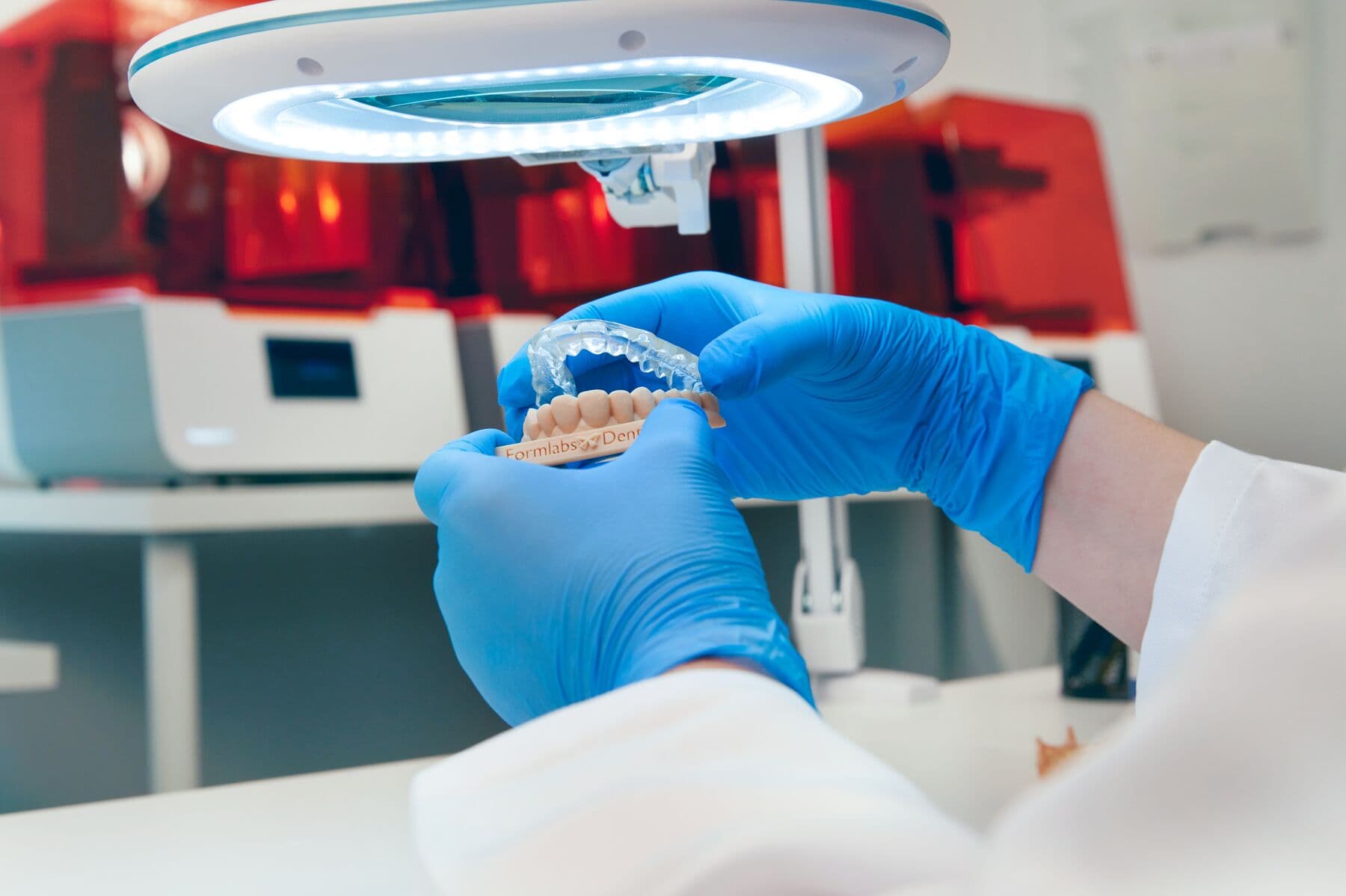 In-House 3D Printing of Occlusal Splint for Patient with Parafunctional habits and Premature Tooth Wear