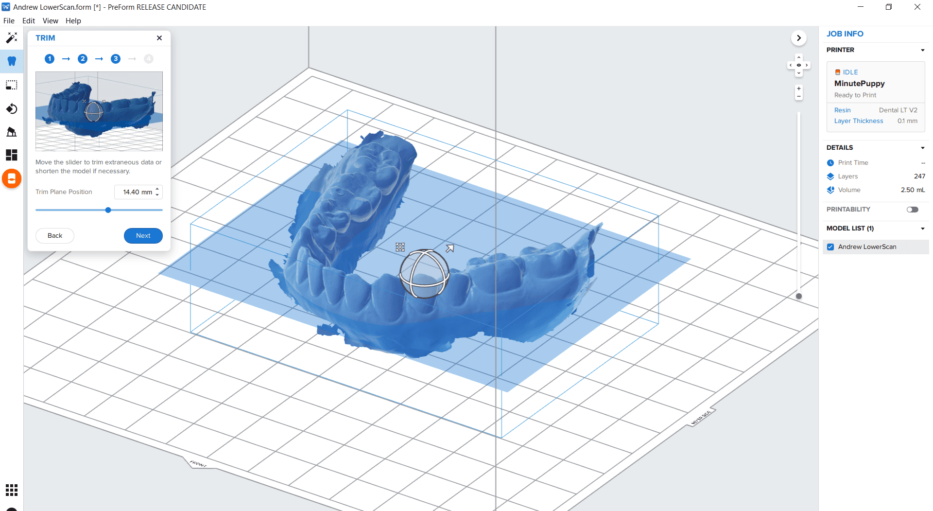 Modell aus Scan: Verwandeln Sie digitale Scans in druckbare Zahnmodelle mithilfe von PreForm