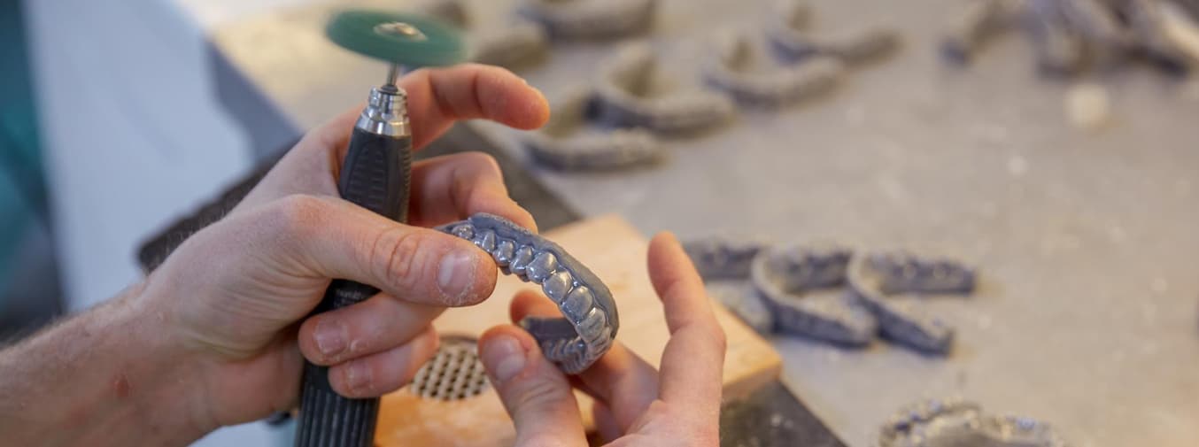 L'ortodonzia digitale su scala: l'esperienza del più grande laboratorio ortodontico del Regno Unito