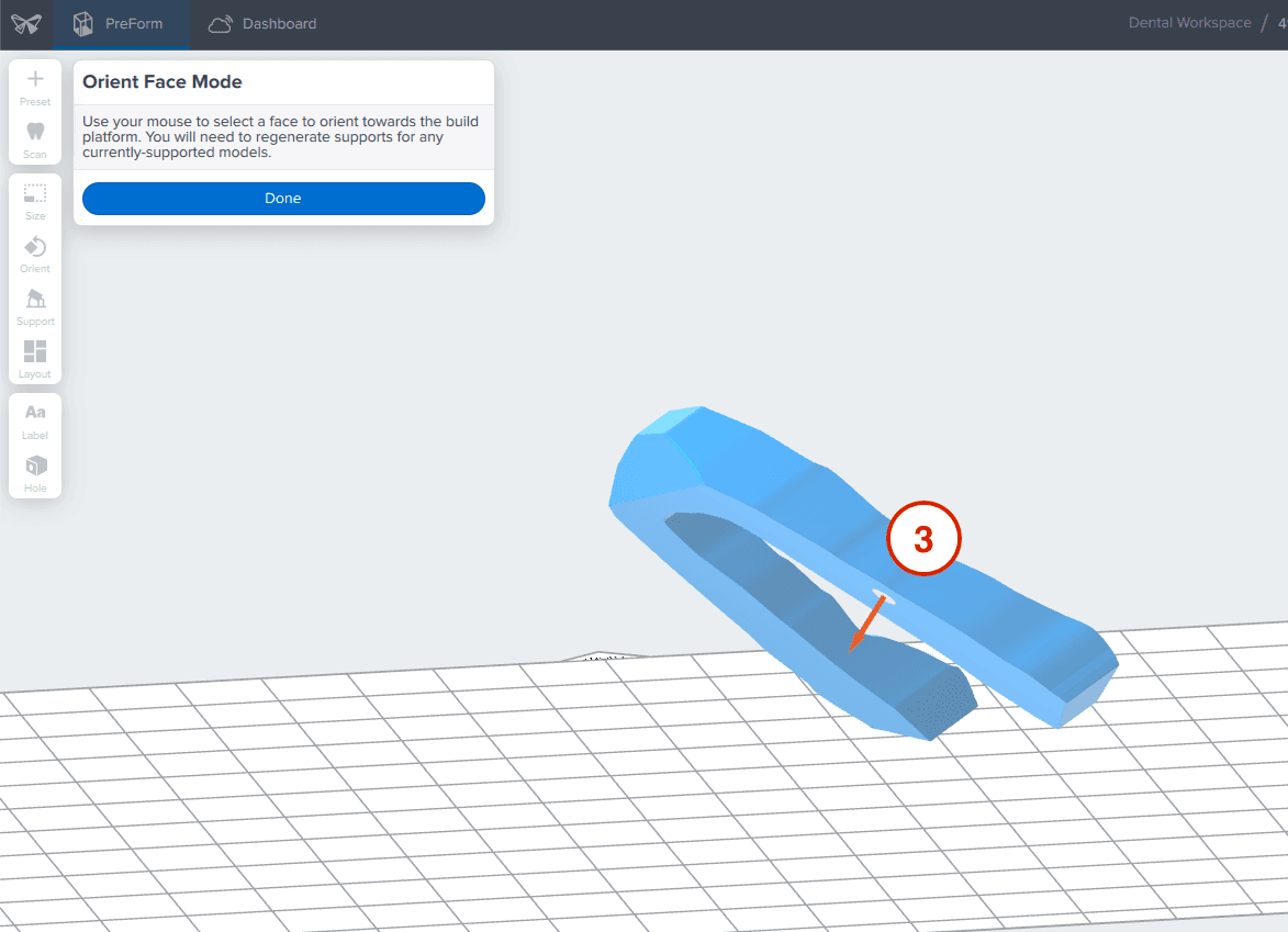 dental model orientation