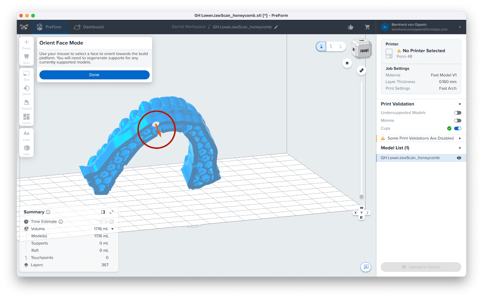 dental model position