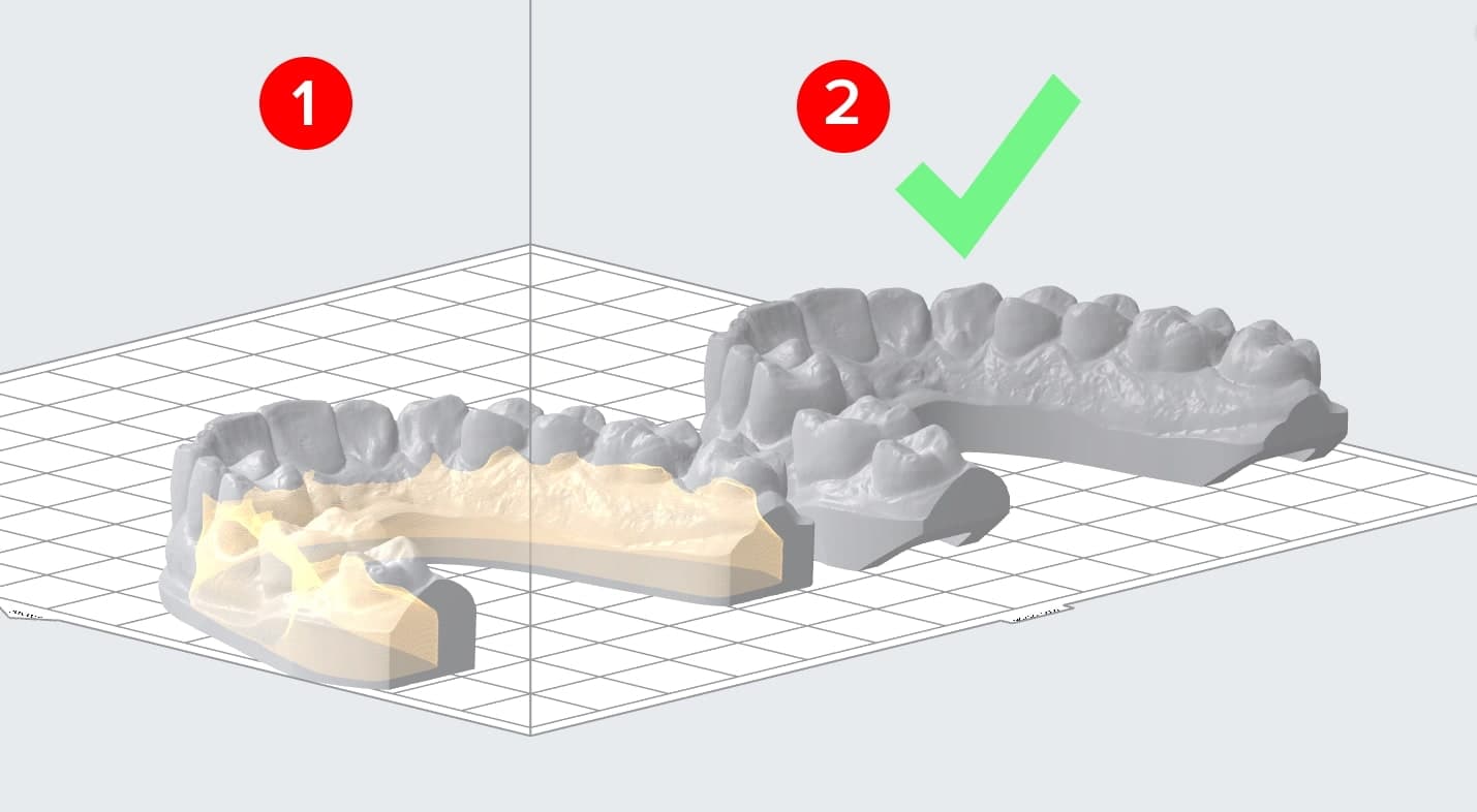 cupping and hollow models
