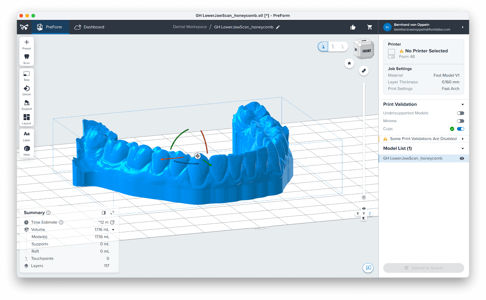 dental model position