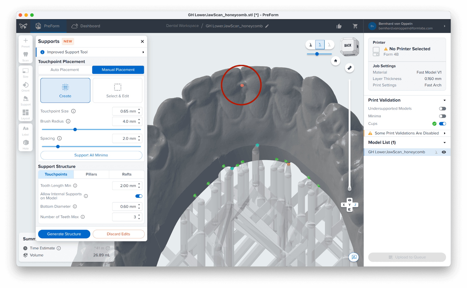 preform unwanted supports