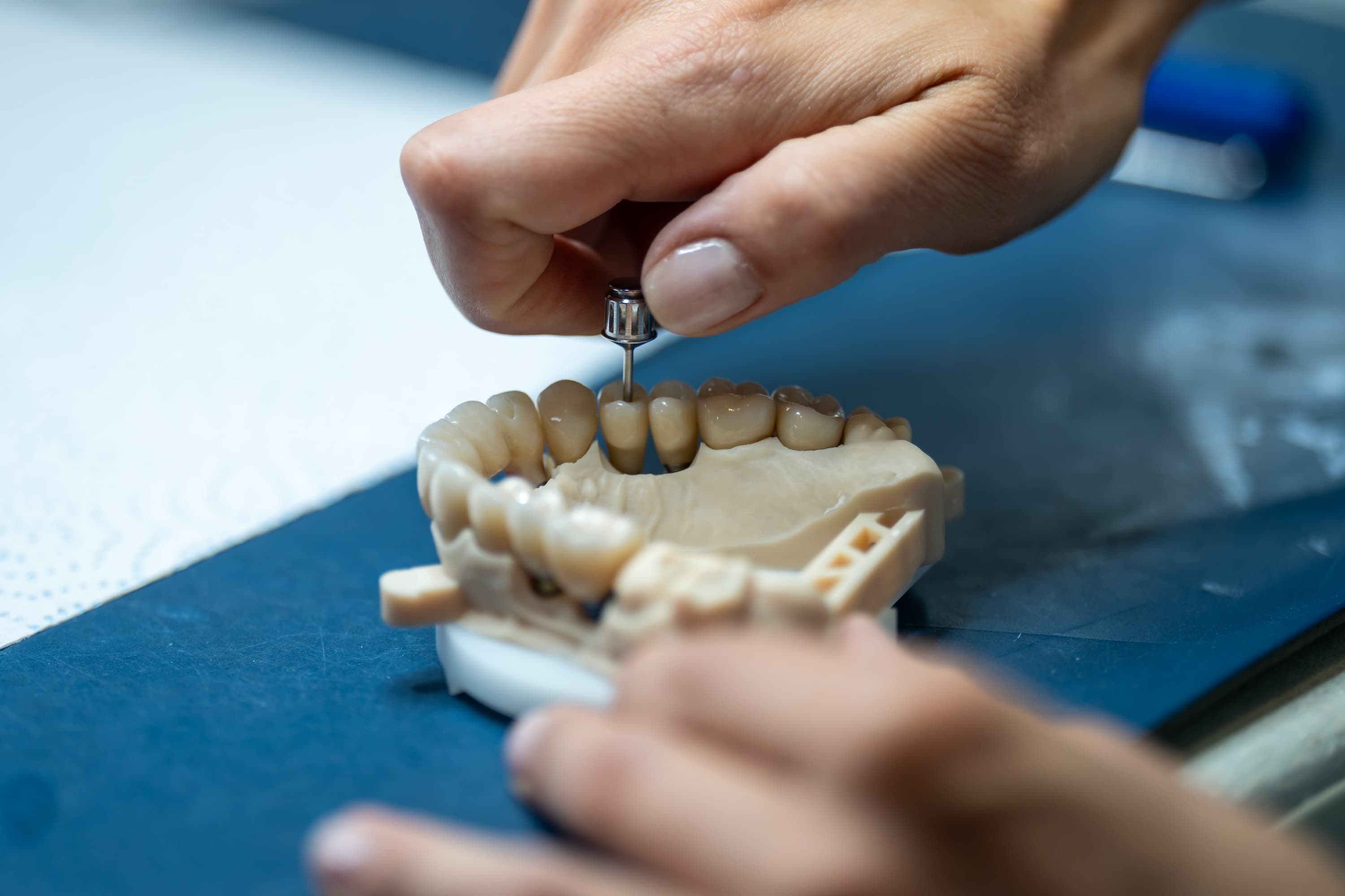 Dental model 3D printed in Precision Model Resin