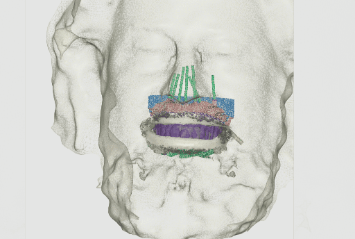 Updated digital patient