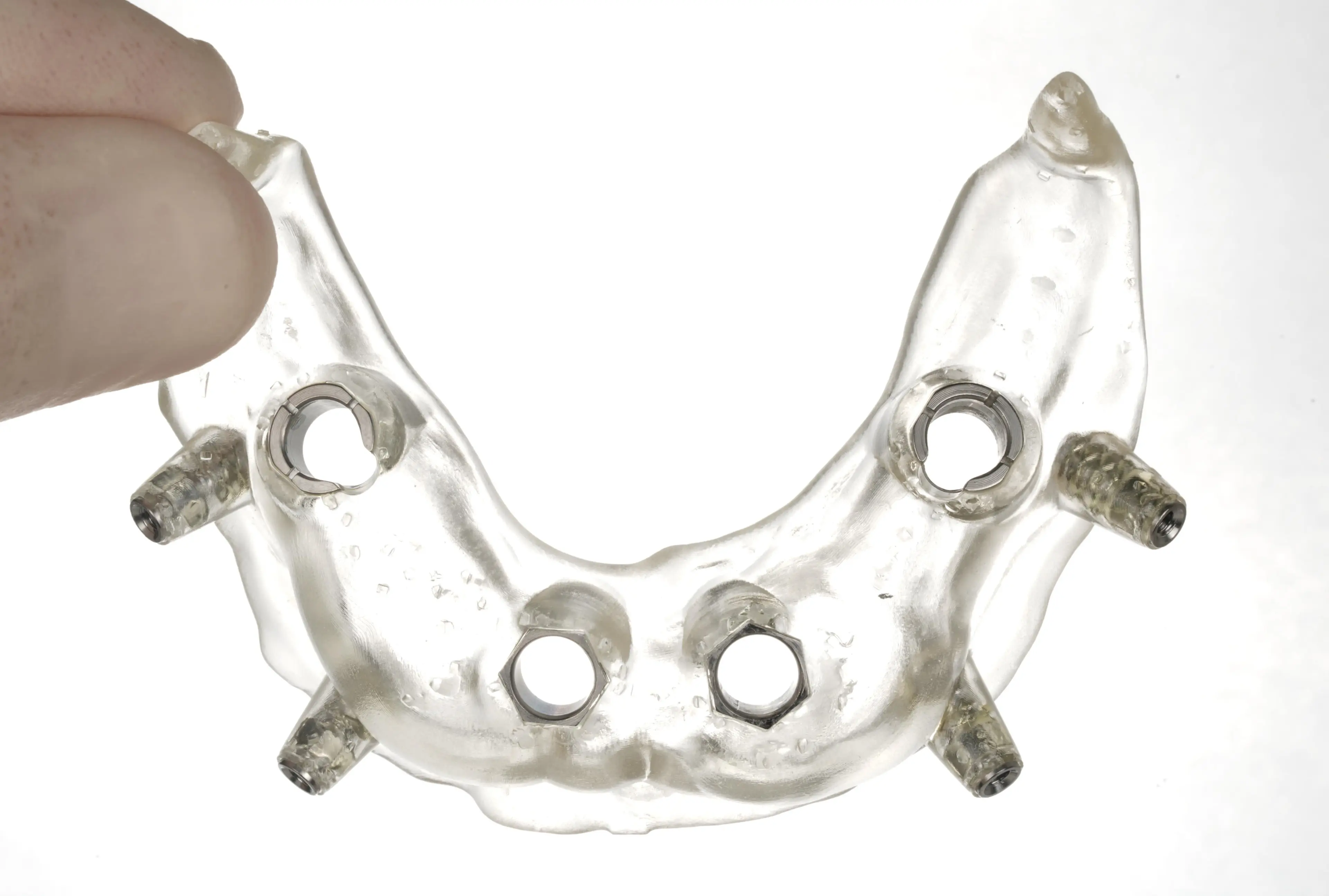 3D printed surgical guide with sleeves