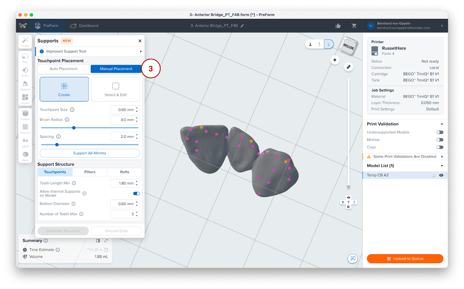 manual support placement