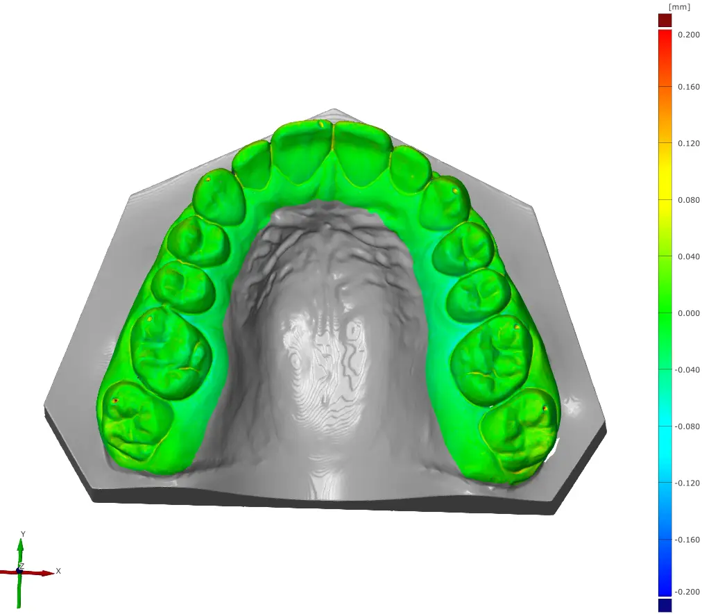 A scan of a restorative model printed at 50 µm layer height.