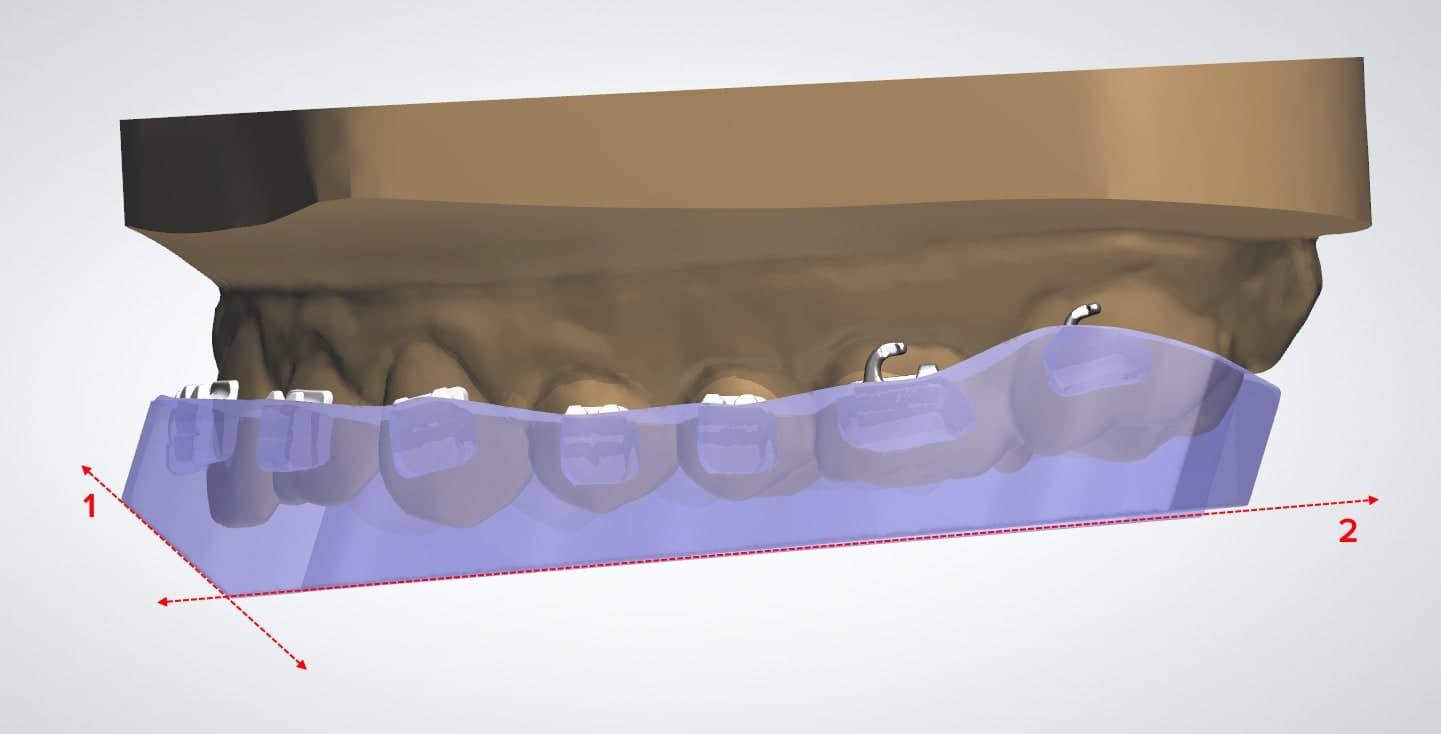dental cad model