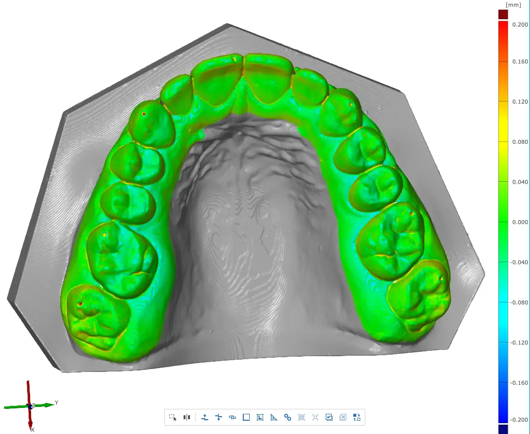A scan of a restorative model printed at 100 µm layer height.