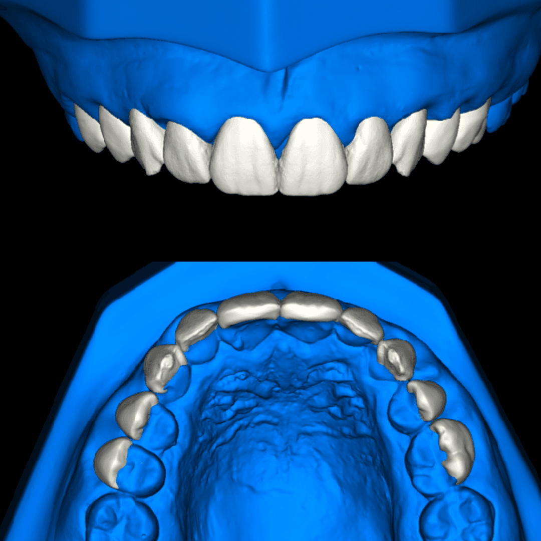 Technical mock-up image