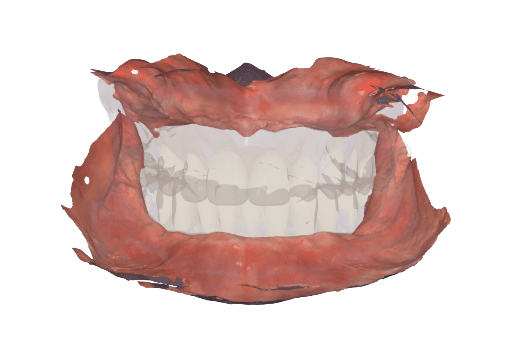 Scan of mouth