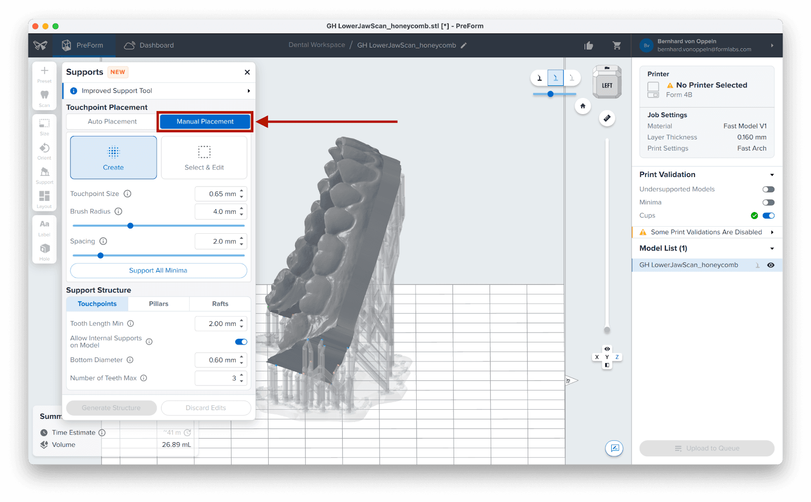 preform manual placement