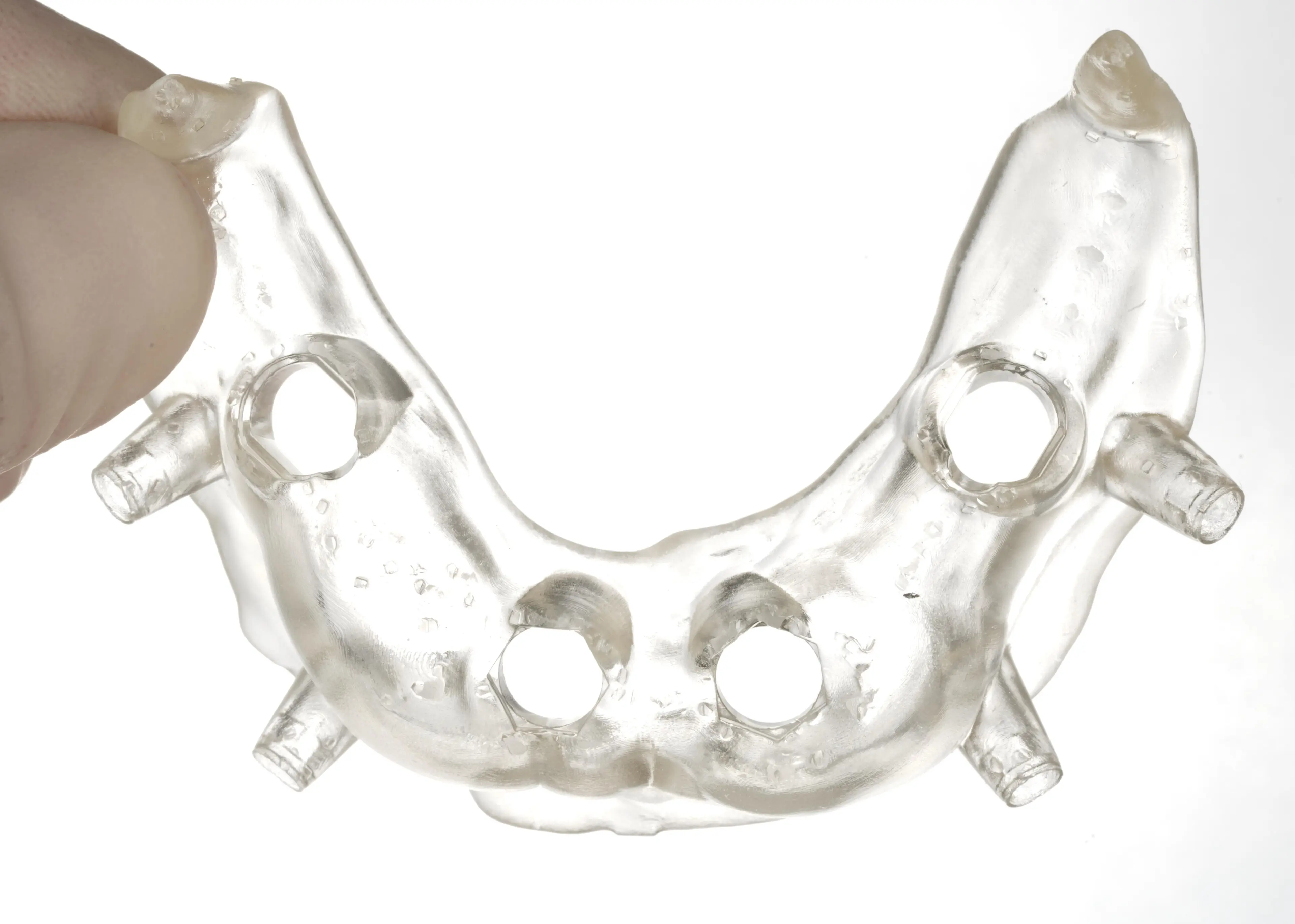 The surgical guide is ready for sleeve insertion.