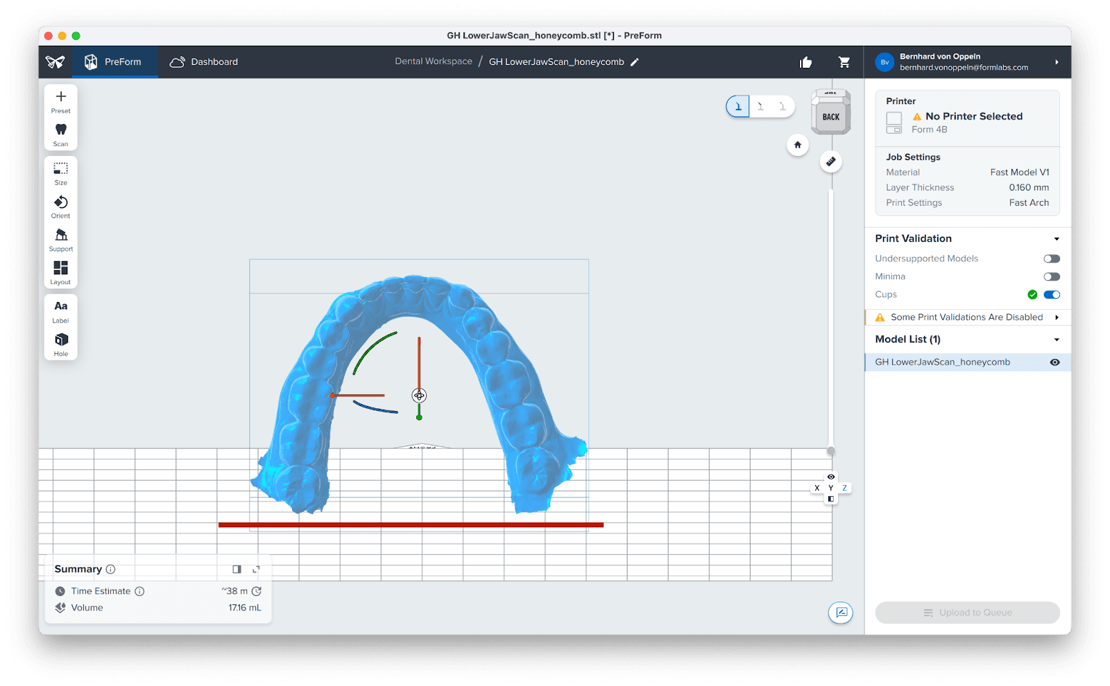 preform dental arch orientation