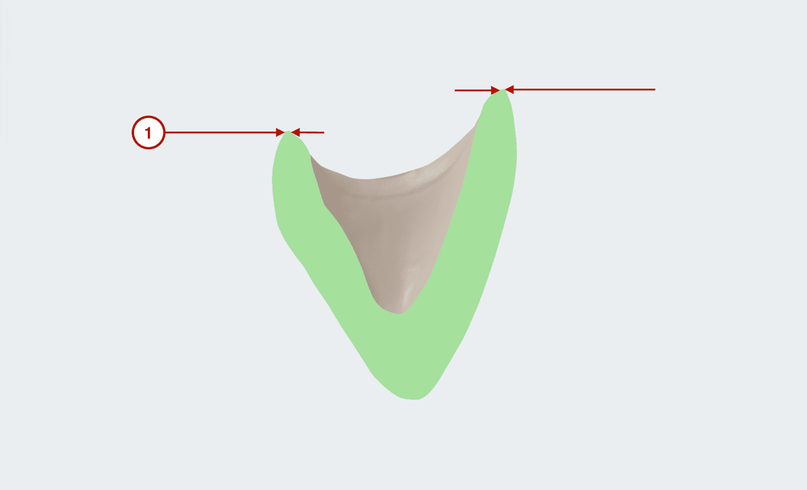 dental 3shape
