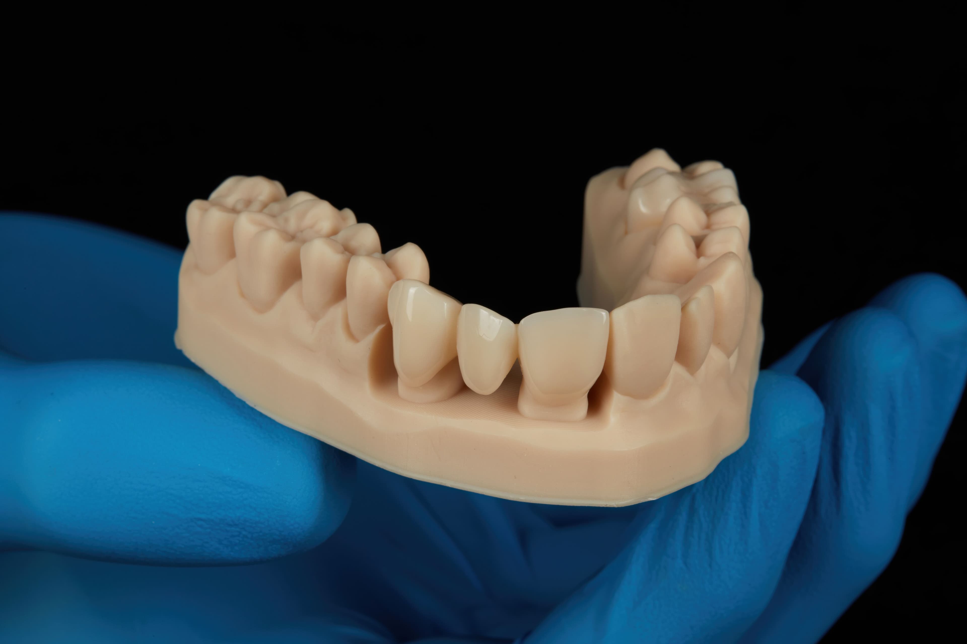 Bego Varseosmile TriniQ Resin