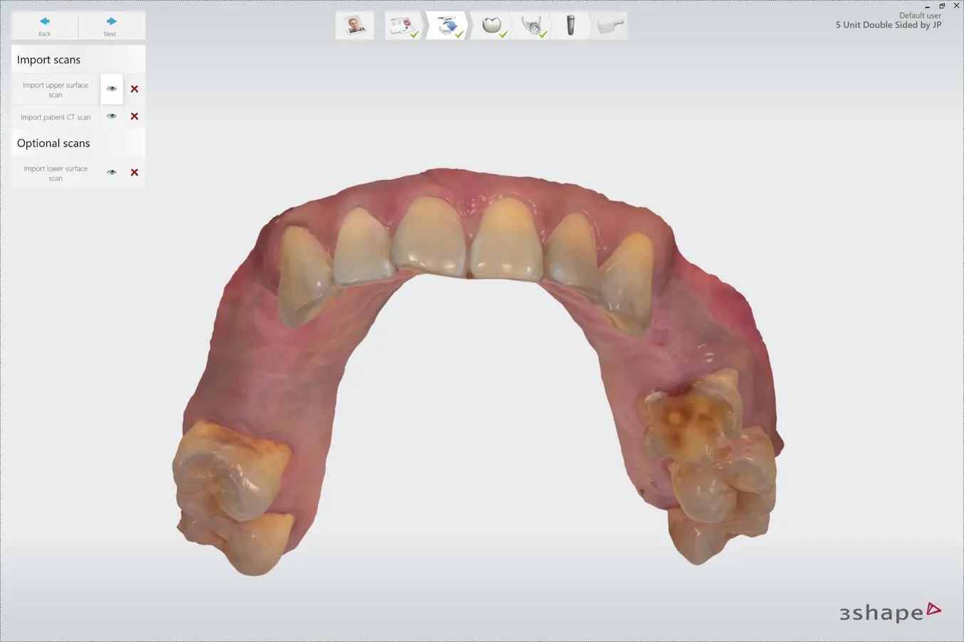 dental scan import