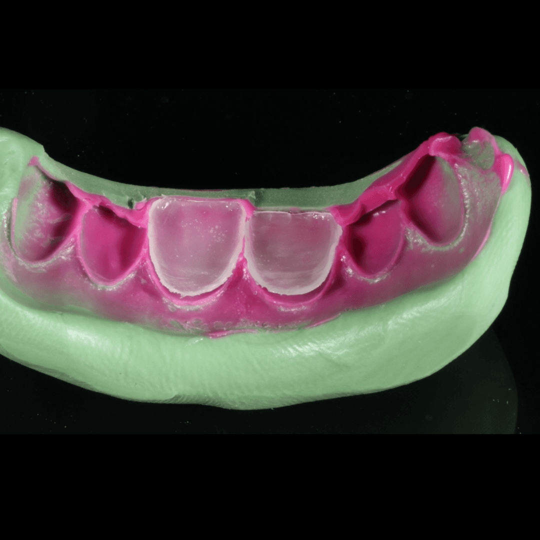 Example of a case
