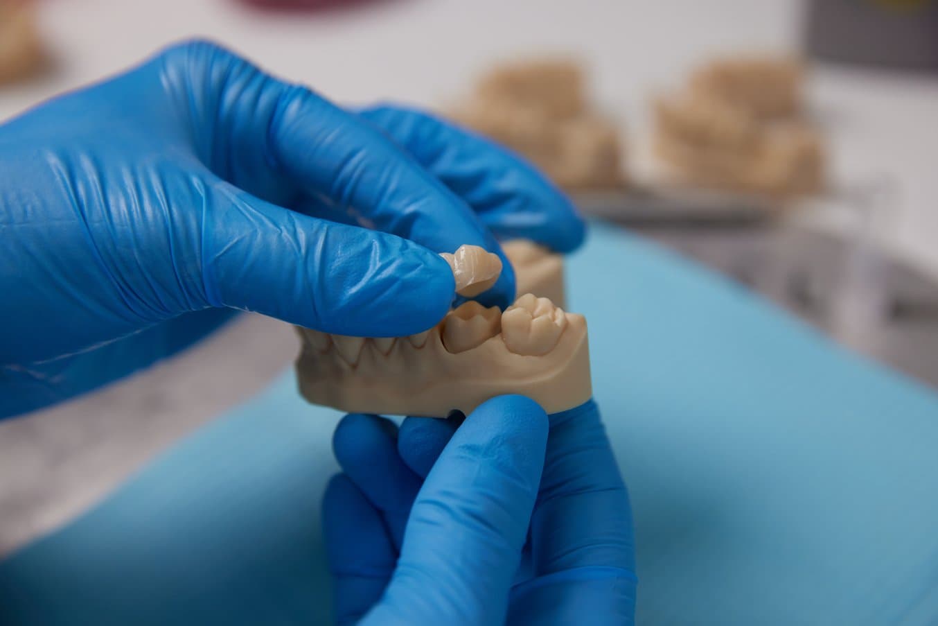 Gloved hands holding a restorative model and a restoration