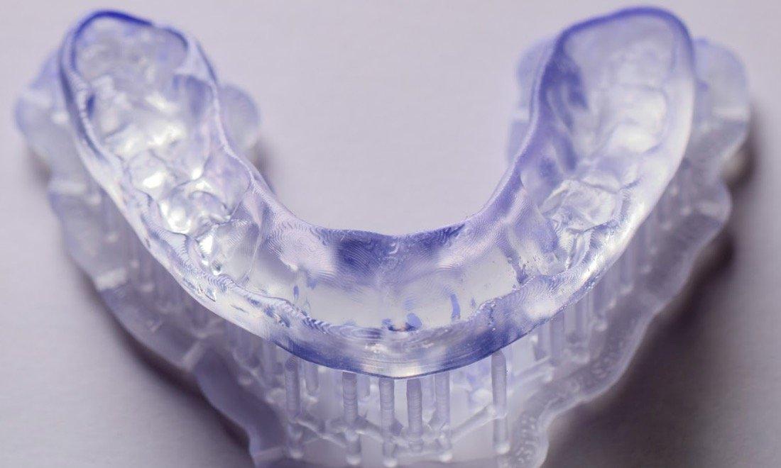Printed occlusal splint still on support structures and after curing.