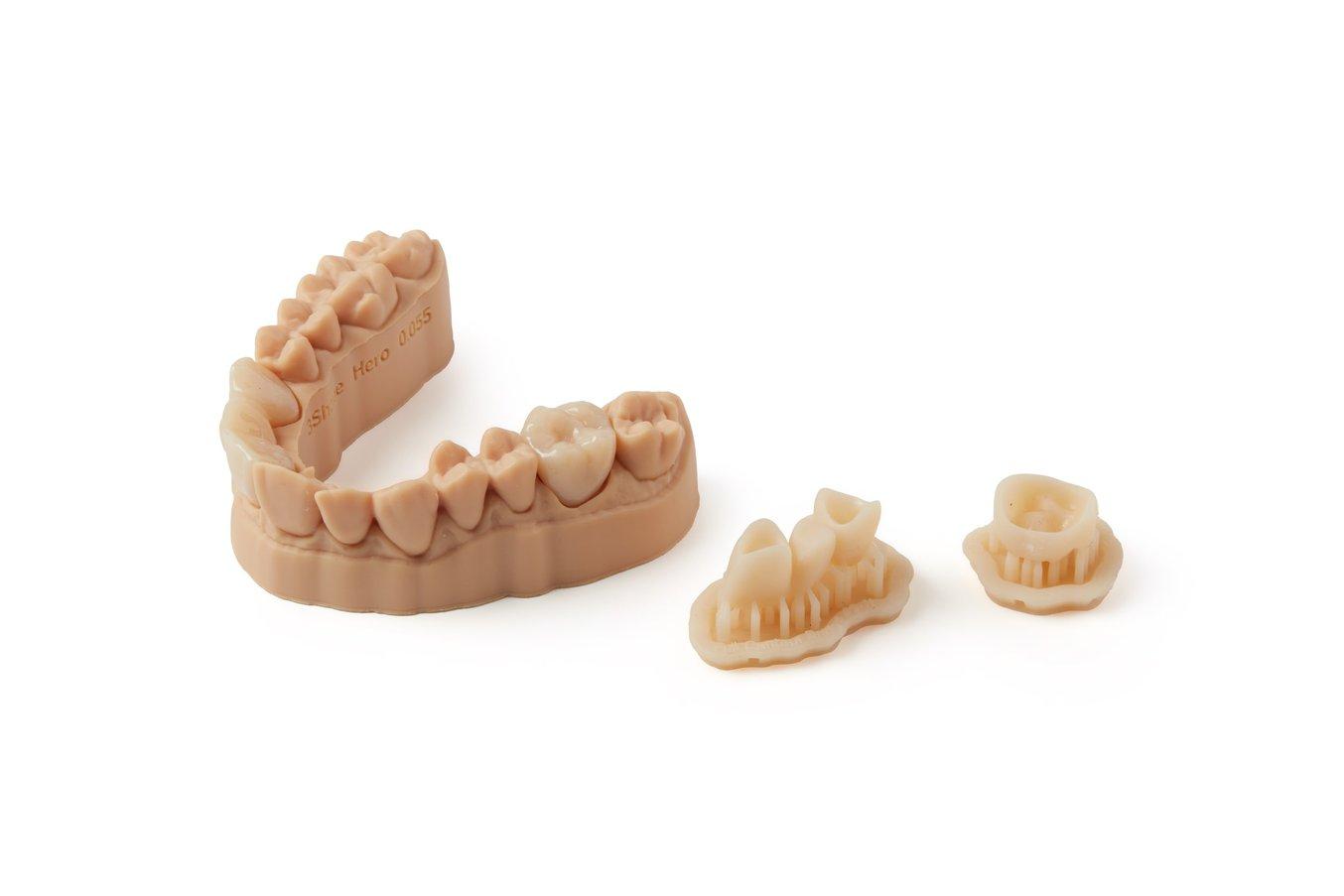 dental temporary crowns and bridges 3d printing