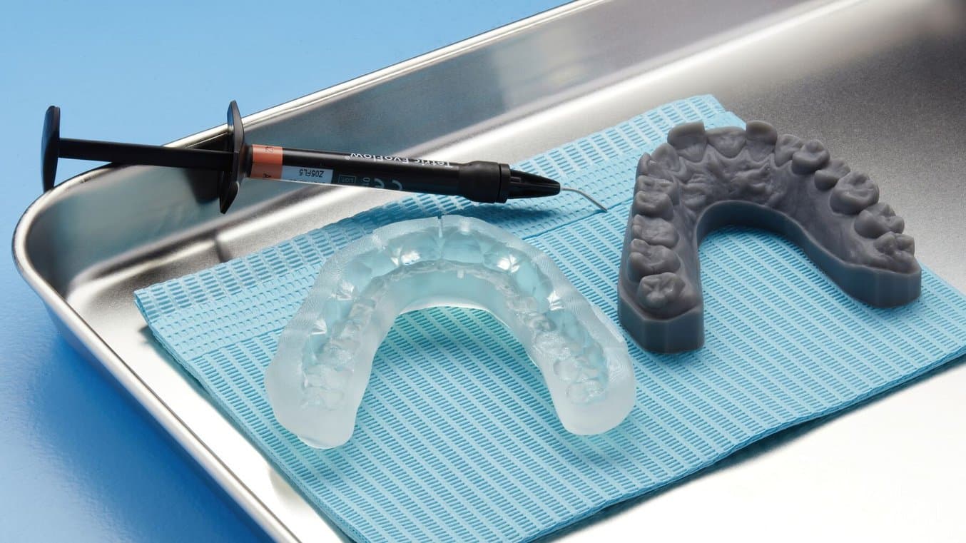 3D printed direct composite restoration guide and a 3D printed indirect bonding tray