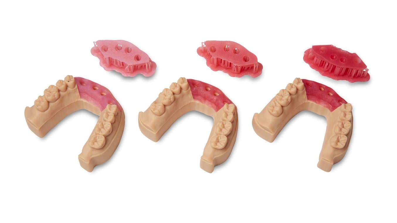 Modèles d’implant imprimés en Model Resin avec masques gingivaux imprimés en Soft Tissue Resin rose pâle, rose moyen et rose vif.