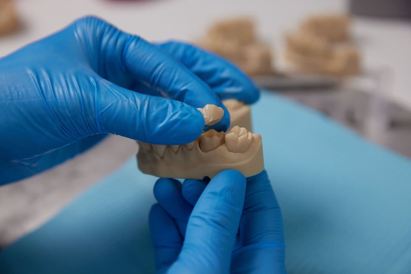 Gloved hands holding a restorative model