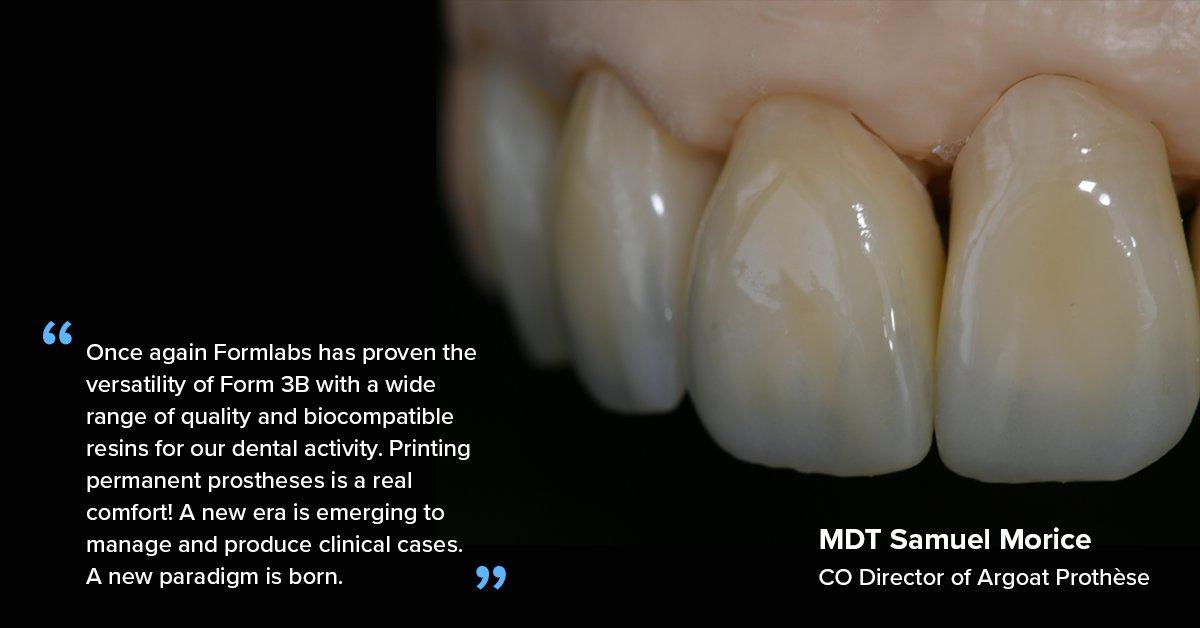 Testimonial quote from MDT Samuel Morice, Argoat Prothèse: “Once again Formlabs has proven the versatility of Form 3B with a wide range of quality and biocompatible resins for our dental activity. Printing permanent prostheses is a real comfort!"