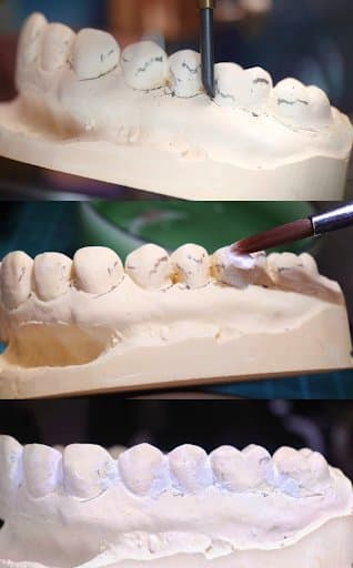 Three stacked photos of a plaster model with tools filling in undercuts