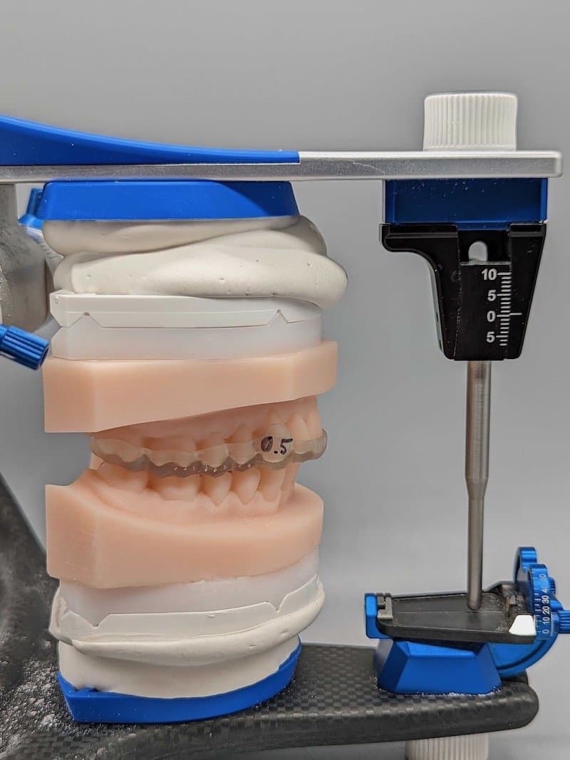 3d printed splint