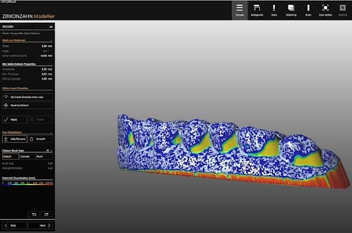 Screenshot of digital filling of undercuts