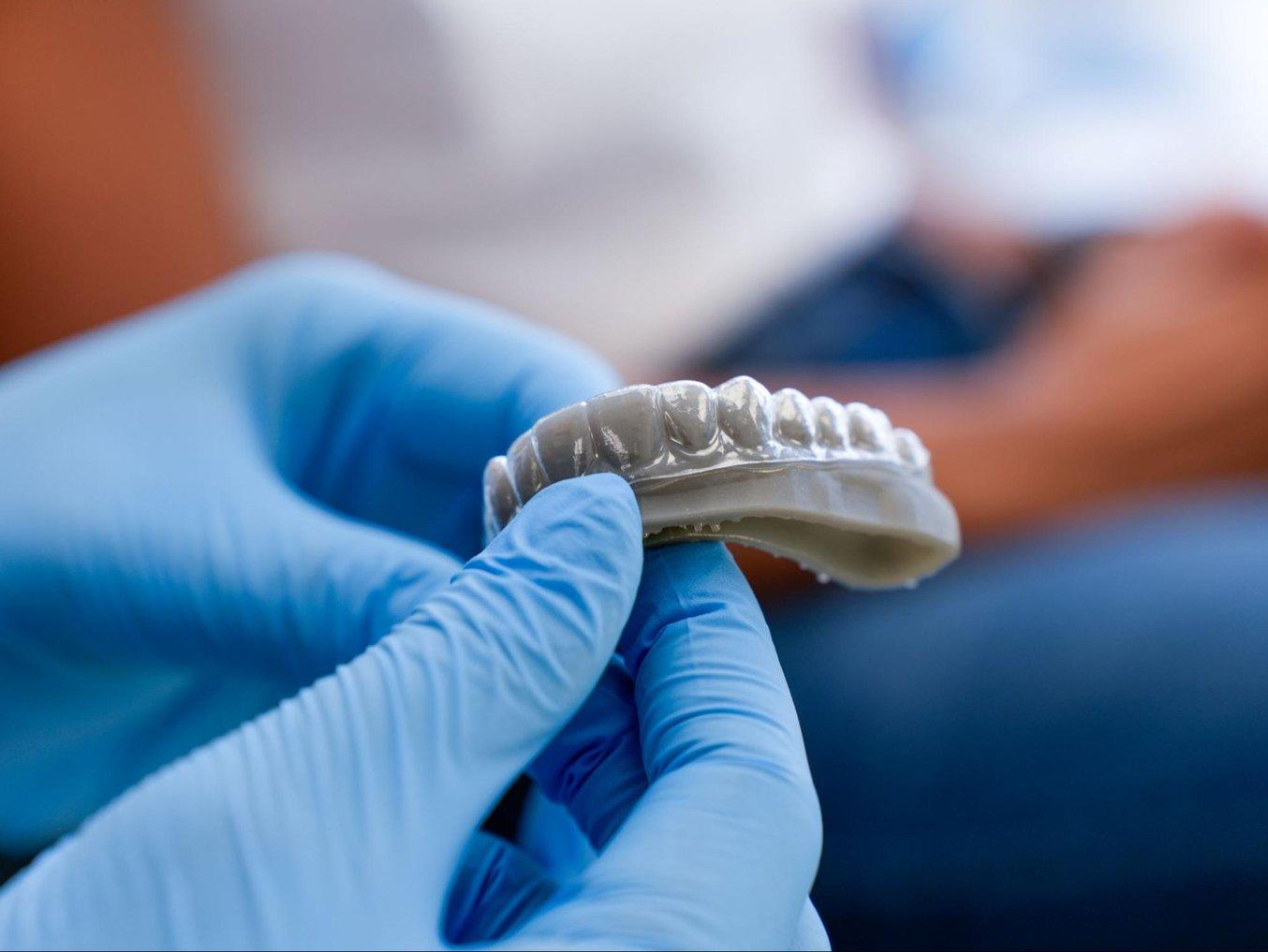 thermoformed aligner on a 3D printed model