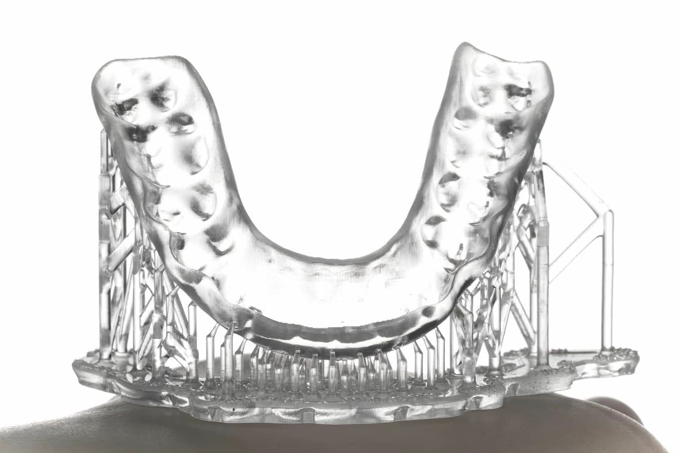 occlusal spint on supports