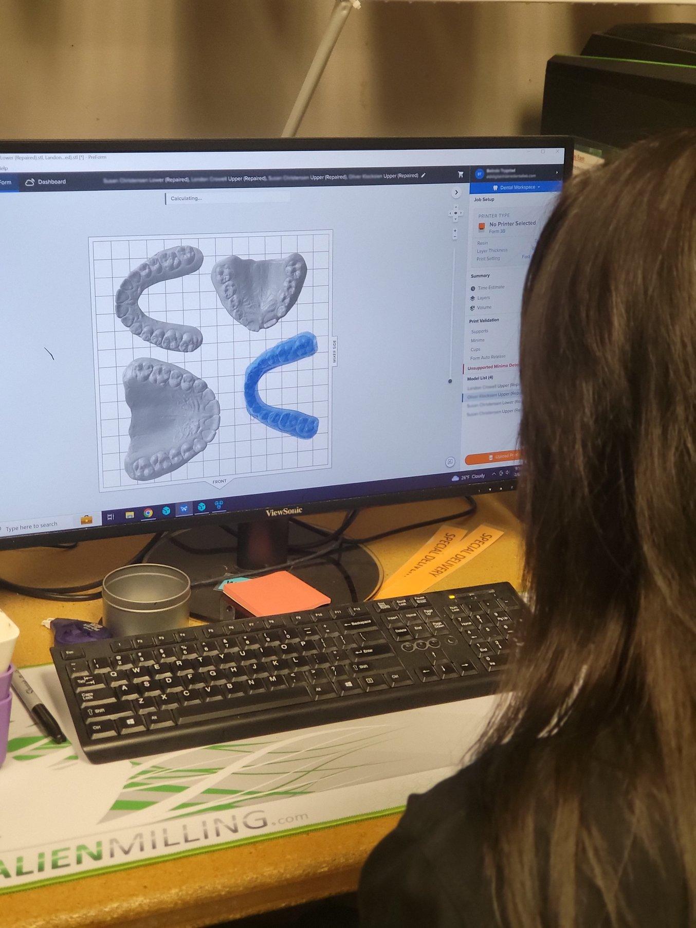 Back of a person's head as they design orthodontic models on a computer