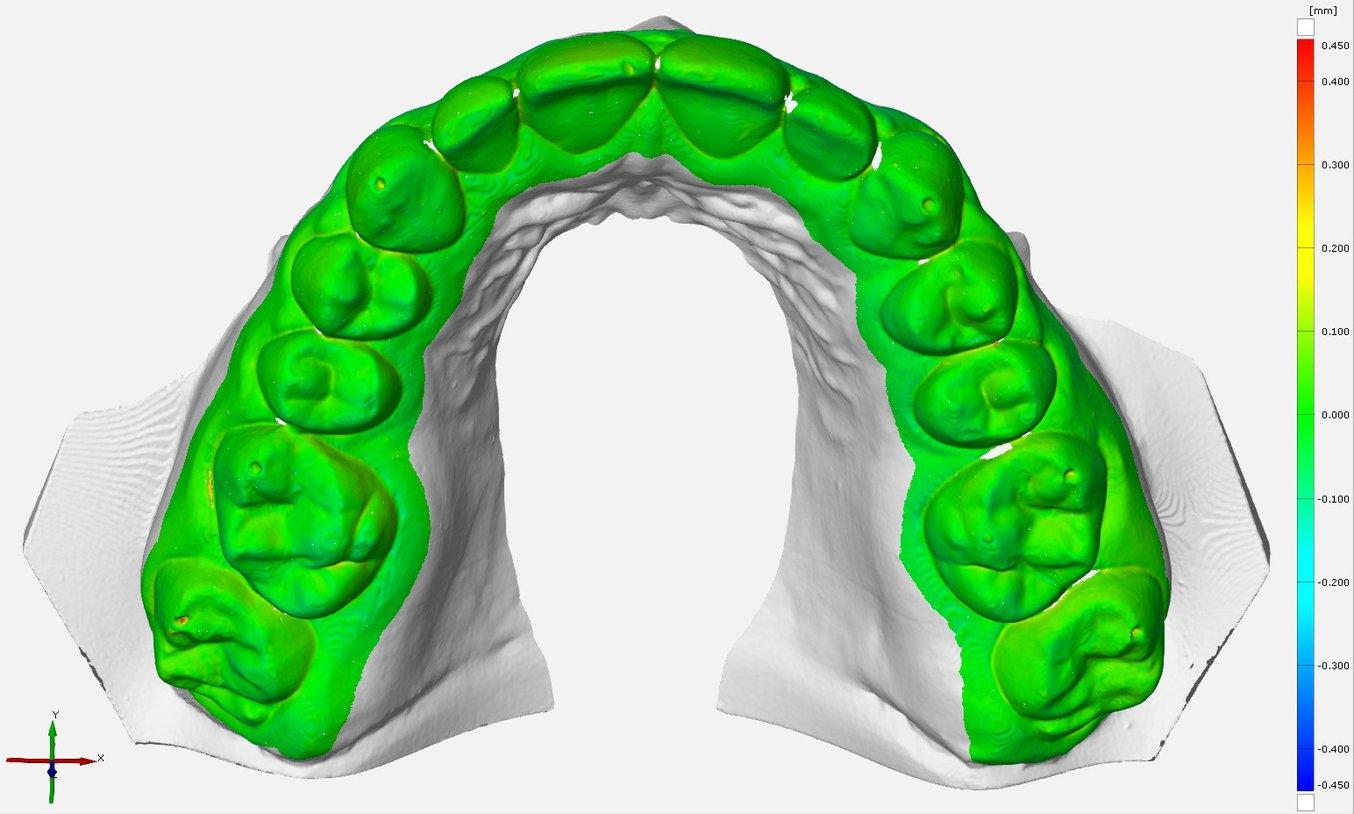 3d printed orthodontic models accuracy