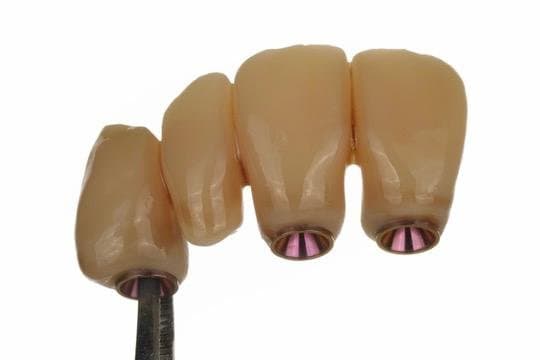 Four units 3D printed with BEGO™ VarseoSmileⓇ TriniQⓇ Resin