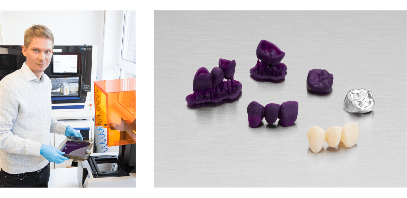 Stephan Kreimer usa la sua stampante 3D Form 2 in-house per diversi tipi di protesi, e recentemente ha aggiunto la Castable Wax Resin al suo catalogo di materiali per lo stampaggio e la fusione.