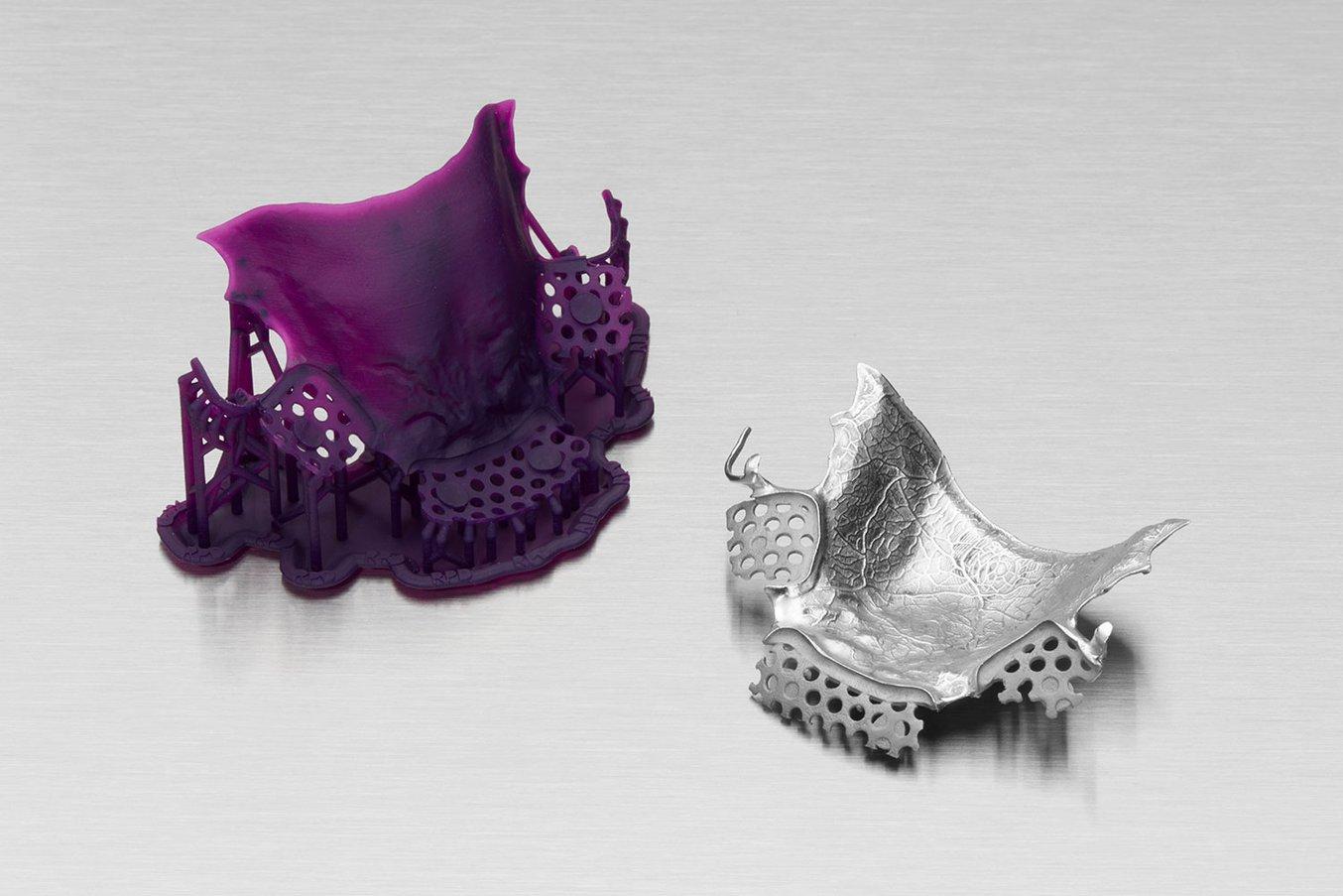 Un modello di scheletrato stampato in 3D con la Castable Wax Resin (a sinistra) e il telaio finale in cromo-cobalto colato (a destra).