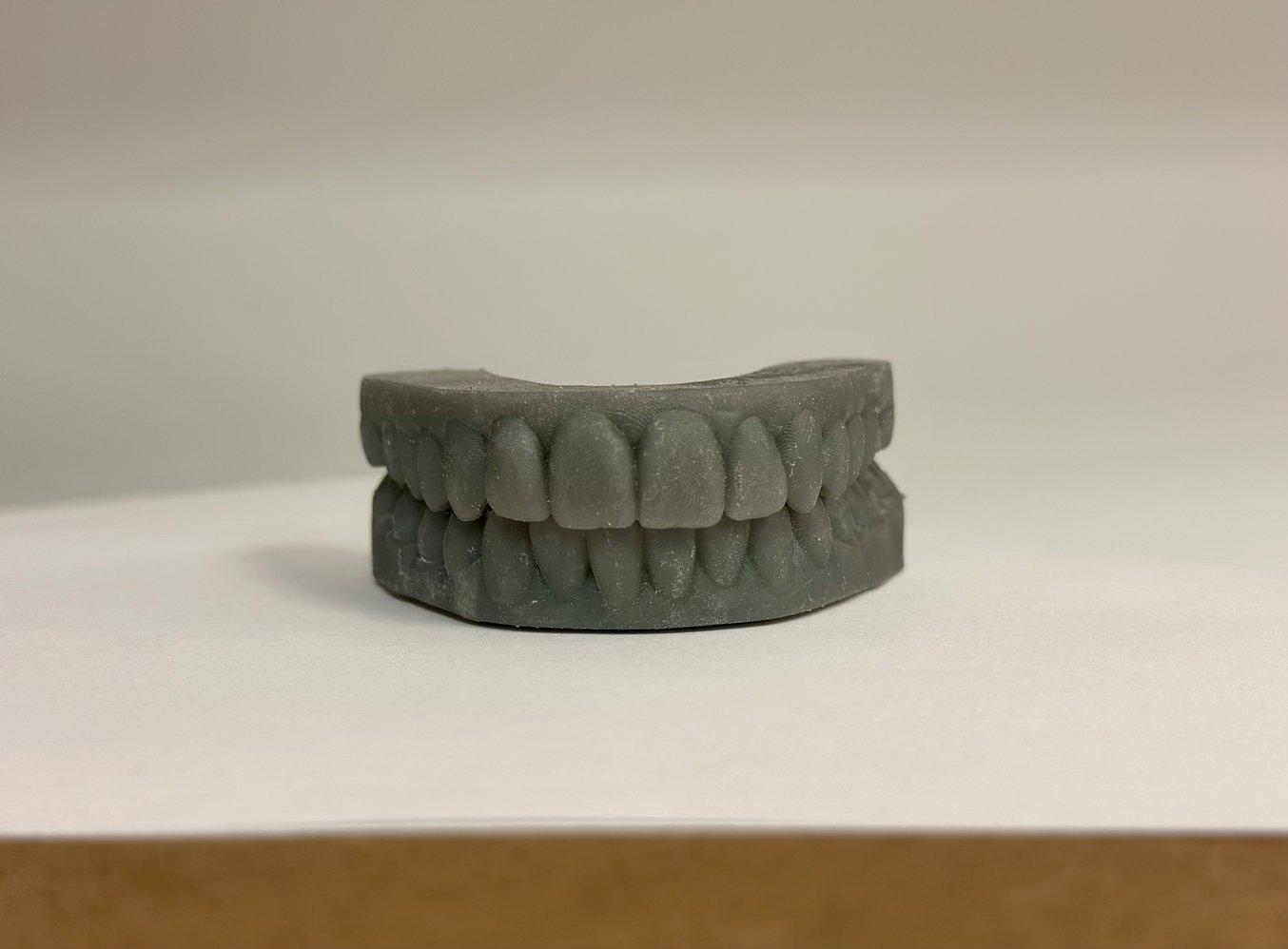 A grey orthodontic model