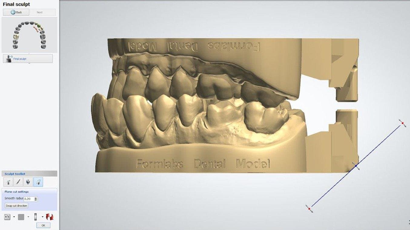 Digital image of a restorative model