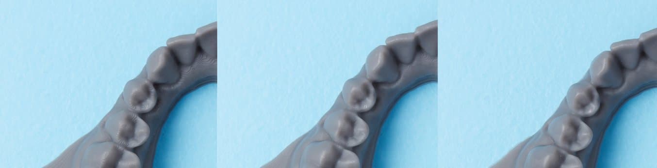 Modèle orthodontique imprimé avec des réglages de 160, 100 et 50 microns (de gauche à droite).