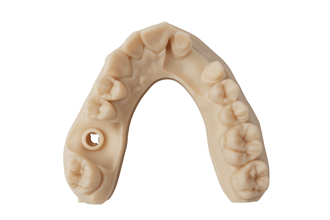 Modello dentale stampato in 3D con la Precision Model Resin
